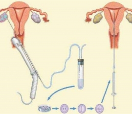 35岁女性备孕请做好以下检查，“健康长春代生宝宝”跑不远